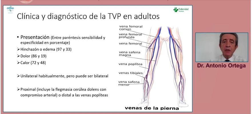 Foto Exposición Dr. Ortega-Diagnóstico ETEV