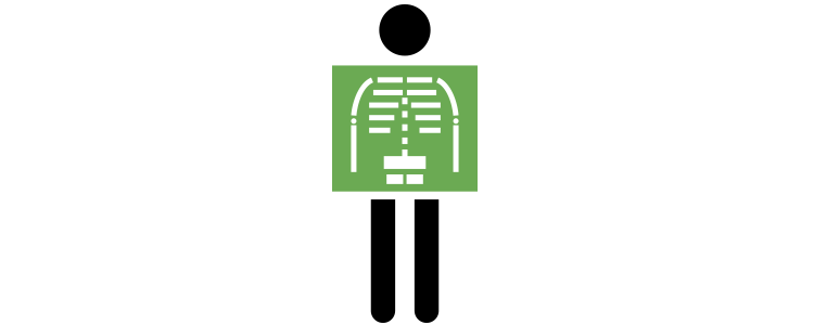 Equipo de radiología digital