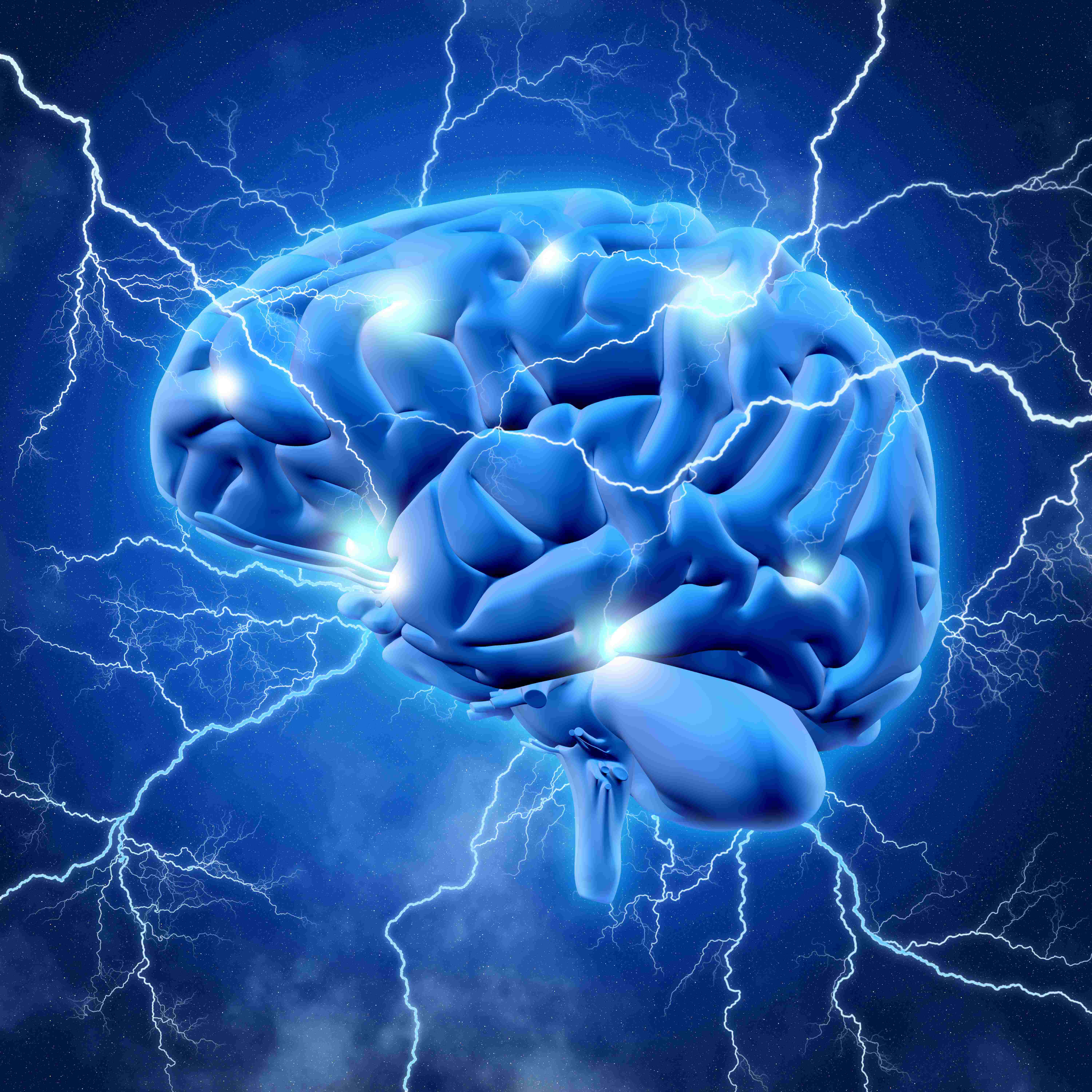 cerebro