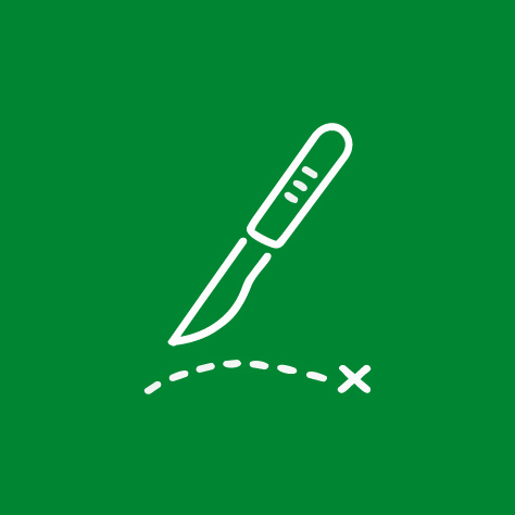 intervención quirurgica