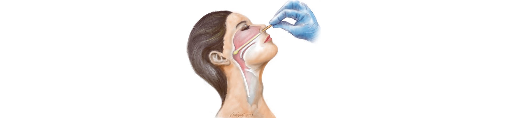 Dibujo PCR