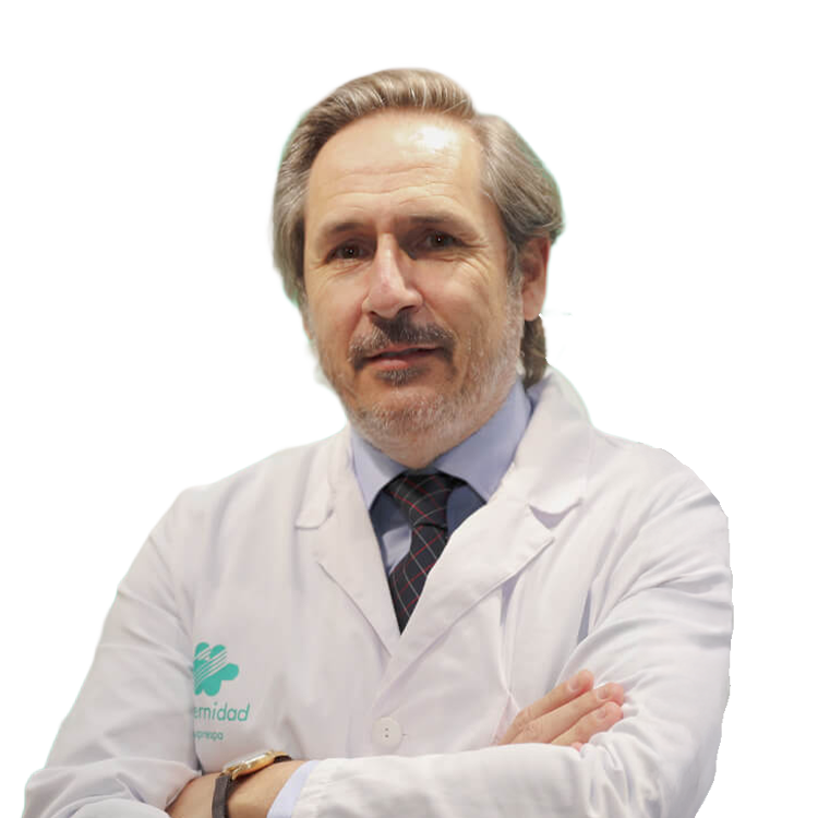 Minuesa, Álvaro
