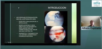 Ventajas de la artroscopia por el DR. Espiniella