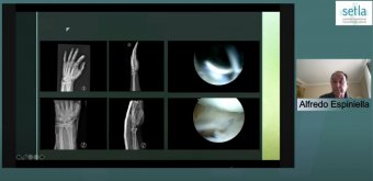 Caso práctico por el DR. Espiniella