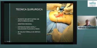 Técnica quirúrgica por el DR. Espiniella
