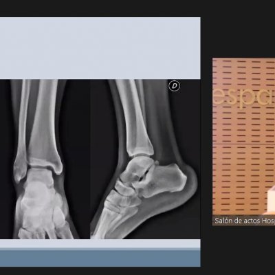 Foto Exposición Dr. Losa_Caso práctico