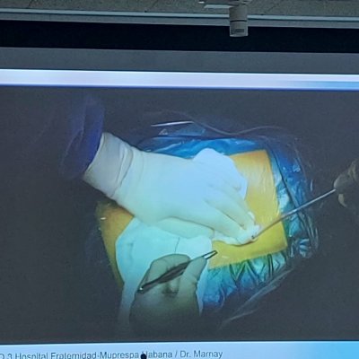 Retransmisión cirugía