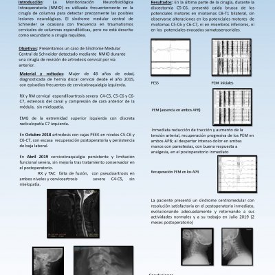 Poster Síndrome Centro-Medular (o de Schneider) Fraternidad-Muprespa