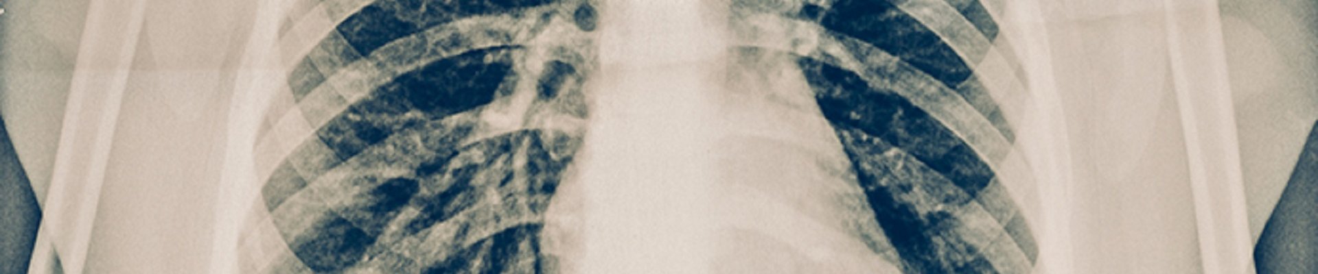 pulmones