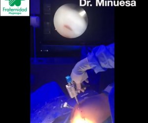 Colocación de un parche Regeneten en un hombro dañado 