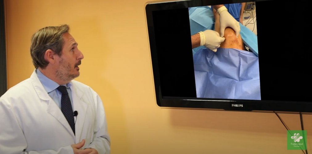 El doctor Álvaro Minuesa, jefe del servicio de Traumatología y Cirugía Ortopédica del Hospital Fraternidad-Muprespa Habana 